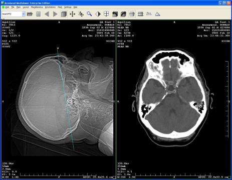 An example of a CT scan image that can be transmitted from a hospital to another medical provider.