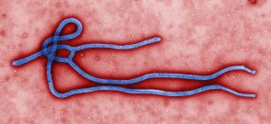 An electron micrograph of an Ebola virus "virion"